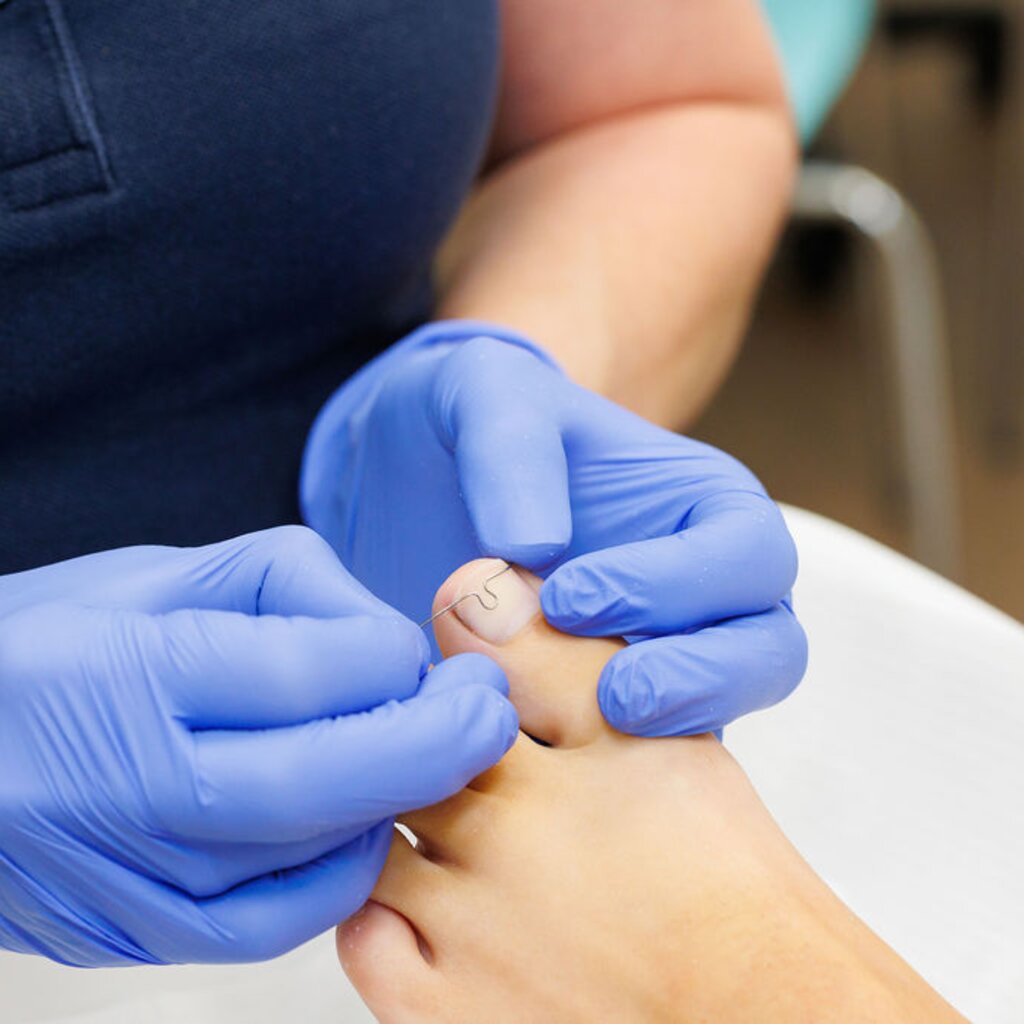 Kim Bakhuis legt podotherapie uit